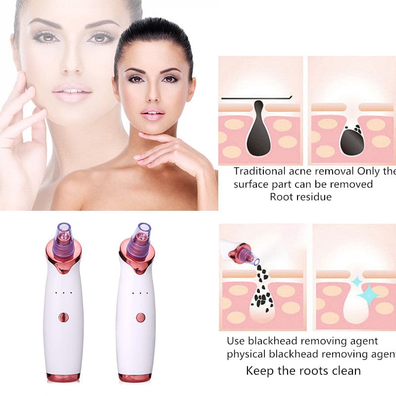 2023 Newest Blackhead Remover Pore Vacuum, Upgraded Black Head Remover for Face, Electric Acne Comedone Whitehead Extractor Tools-5 Suction Power, 5 Probes, USB Rechargeable Pimple Popper Tool Kit
